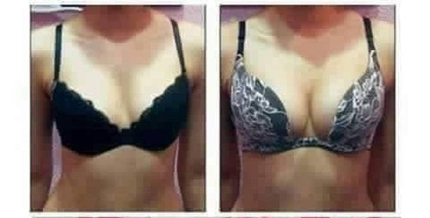 Breast Enlargement & Tightening Capsules - (GET RID OF SMALL BREASTS) (also good for Asymmetrical Breast )