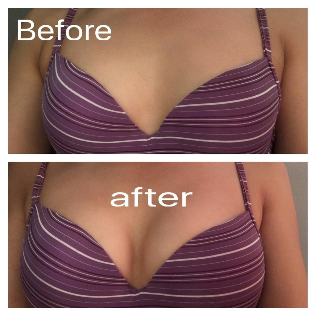 Breast Enlargement & Tightening Capsules - (GET RID OF SMALL BREASTS) (also good for Asymmetrical Breast )