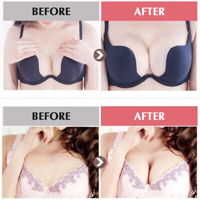 Breast Enlargement & Tightening Capsules (NO MORE SAGGY)
